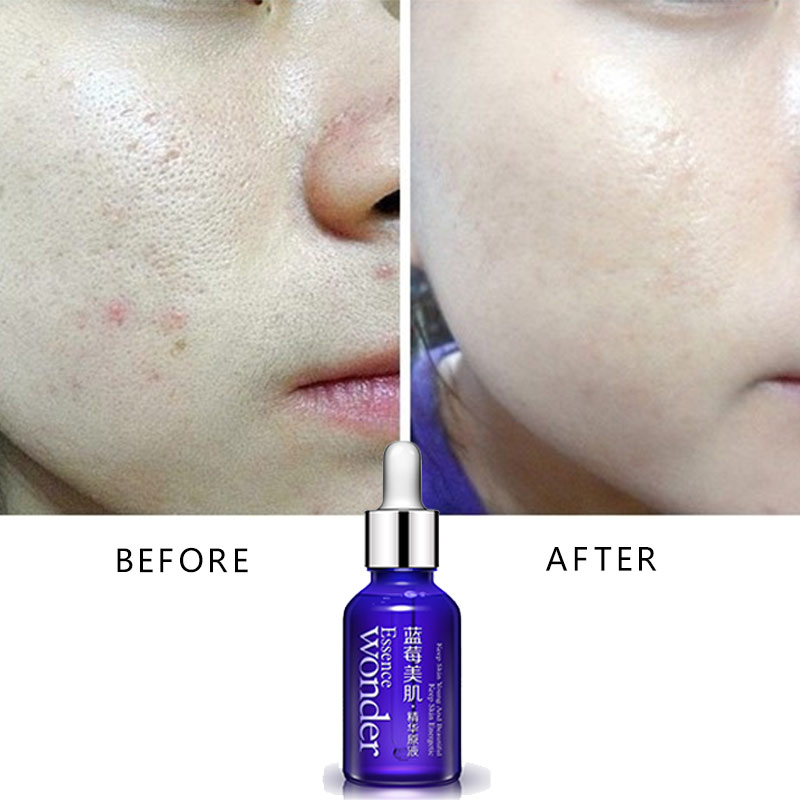 BIOAQUA – sérum de Lifting du  - Skincare Bioaqua avis et prix